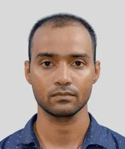 Hair Transplant Before Results - Best Hair Transplant in Delhi